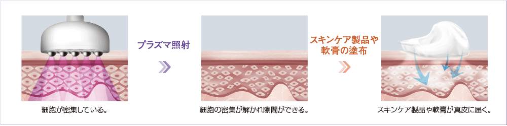 多様なチップで機能性UP肌の引き締めと肌の再生