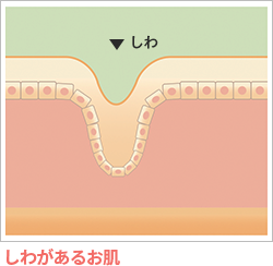 しわがあるお肌